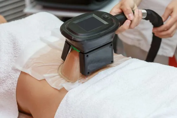 Image of person having fat freezing treatment to help weight gain Stow on the Wold