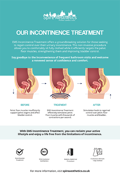 image to show how EMS treatment works for female urinary incontinence Stow on the Wold