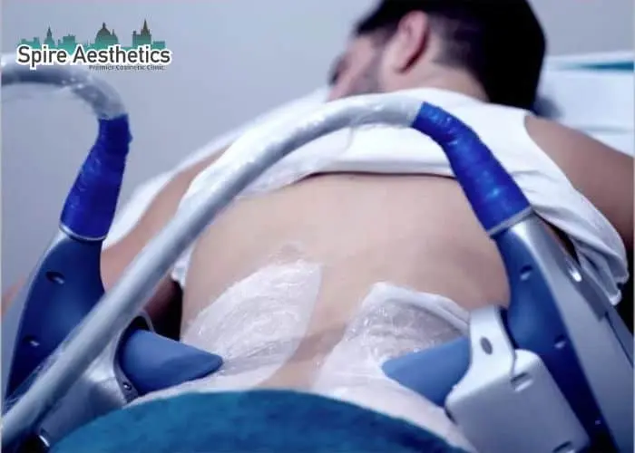 Man having fat freezing treatment done on love handles before a competitions Stow on the Wold to create a sculpted look.